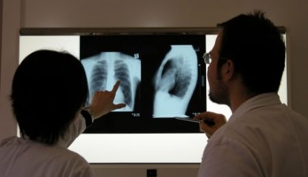 România, pe primul loc în UE la numărul de persoane diagnosticate cu tuberculoză