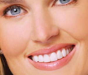 Fatetele dentare – perfectiunea zambetului