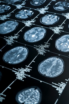 brain_activity
