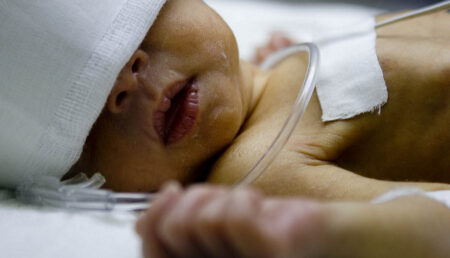 Bebelușul intrat în stop cardio-respirator după botez a murit în această dimineață