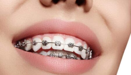 Ortodonția, calea spre un zâmbet perfect