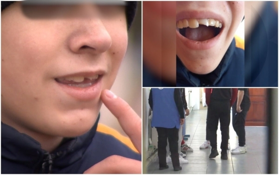 Șocant! Copil bătut la ora de biologie! „Mi-a spart dinții din gură şi nimeni nu a luat nicio măsură”