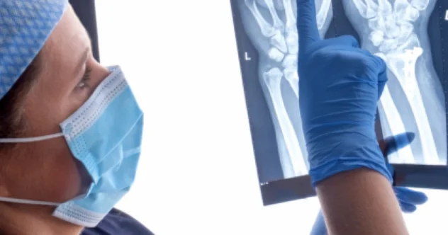 Adeziv-minune inventat de chinezi! Oase rupte, lipite în 3 minute
